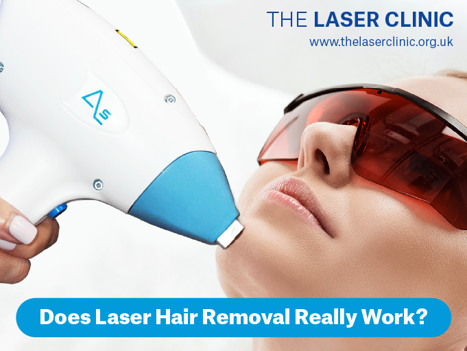 Does Laser Hair Removal Really Work? - The Laser Clinic Morpeth