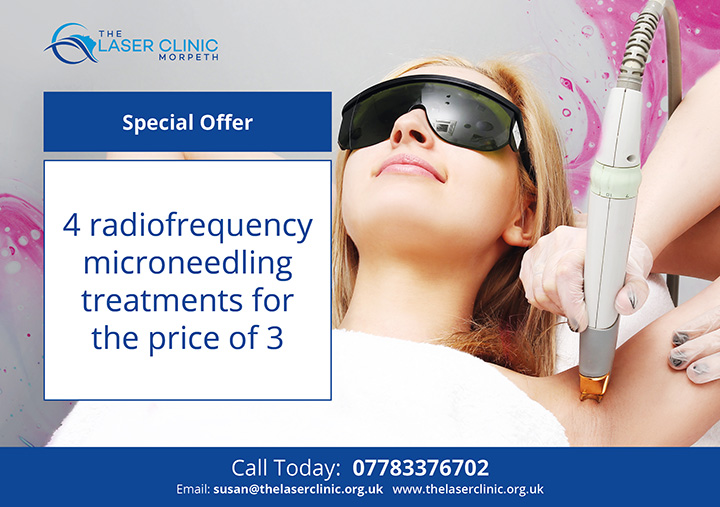 RF Microneedling Special offer