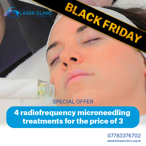 Tis the Season for Skin Rejuvenation with Radiofrequency Microneedling