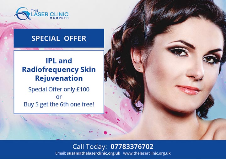 The Combination of Radiofrequency and IPL for Effective Skin Rejuvenation